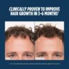 Nutrafol Men's Hair Growth Supplements, Clinically Tested for Visibly Thicker Hair and Scalp Coverage, Hair Loss Treatment Dermatologist Recommended - 1 Month Supply 6 Nutrafol men’s hair growth supplements – 1 month supply, dermatologist recommended for visibly thicker hair