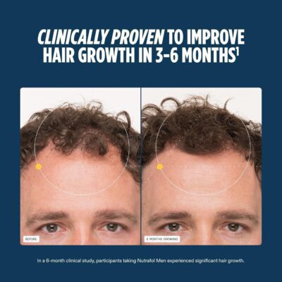 Nutrafol Men's Hair Growth Supplements, Clinically Tested for Visibly Thicker Hair and Scalp Coverage, Hair Loss Treatment Dermatologist Recommended - 1 Month Supply 9 Nutrafol men’s hair growth supplements – 1 month supply, dermatologist recommended for visibly thicker hair