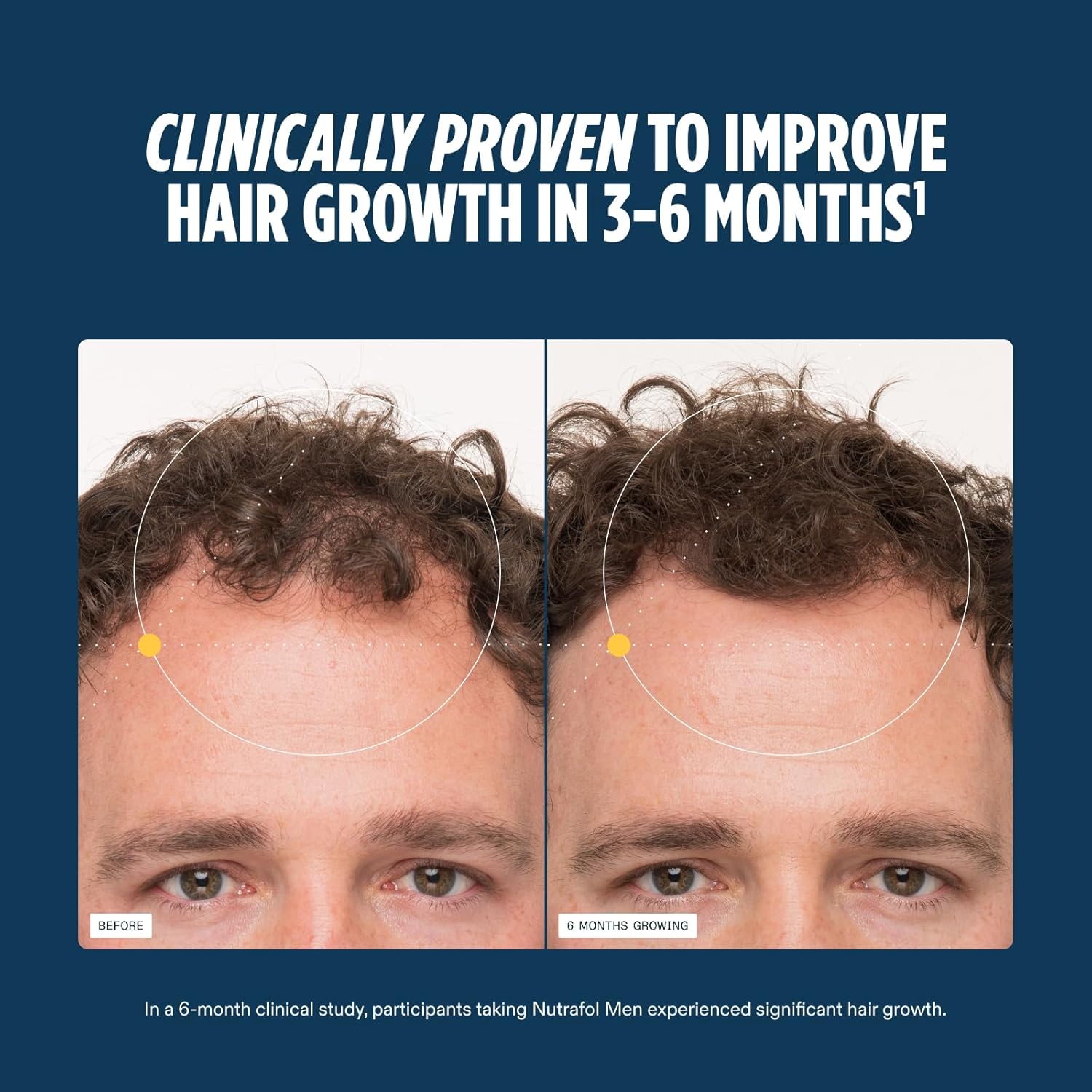 Nutrafol Men's Hair Growth Supplements, Clinically Tested for Visibly Thicker Hair and Scalp Coverage, Hair Loss Treatment Dermatologist Recommended - 1 Month Supply 3 Nutrafol men’s hair growth supplements – 1 month supply, dermatologist recommended for visibly thicker hair